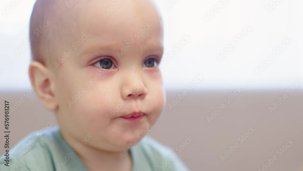 conjunctivitis on eye of little child kid. baby portrait with pink eye crusting of eyelids lashes viral conjunctivitis. pediatric problem children disease eyes itching, irritation redness cold and flu conjunctivitis on eye of little child kid. baby portrait with pink eye crusting of eyelids lashes viral conjunctivitis. pediatric problem children disease eyes itching, irritation redness cold and flu