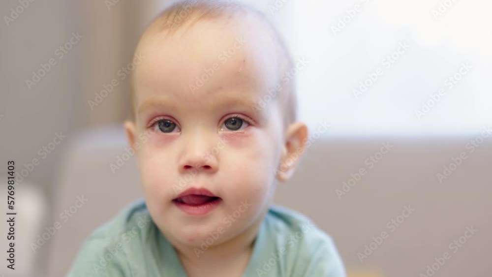 eyes conjunctivitis illness ophthalmology disease on baby kid. portrait child face with pink eye