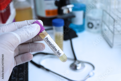 phencyclidine test to look for abnormalities from Urine