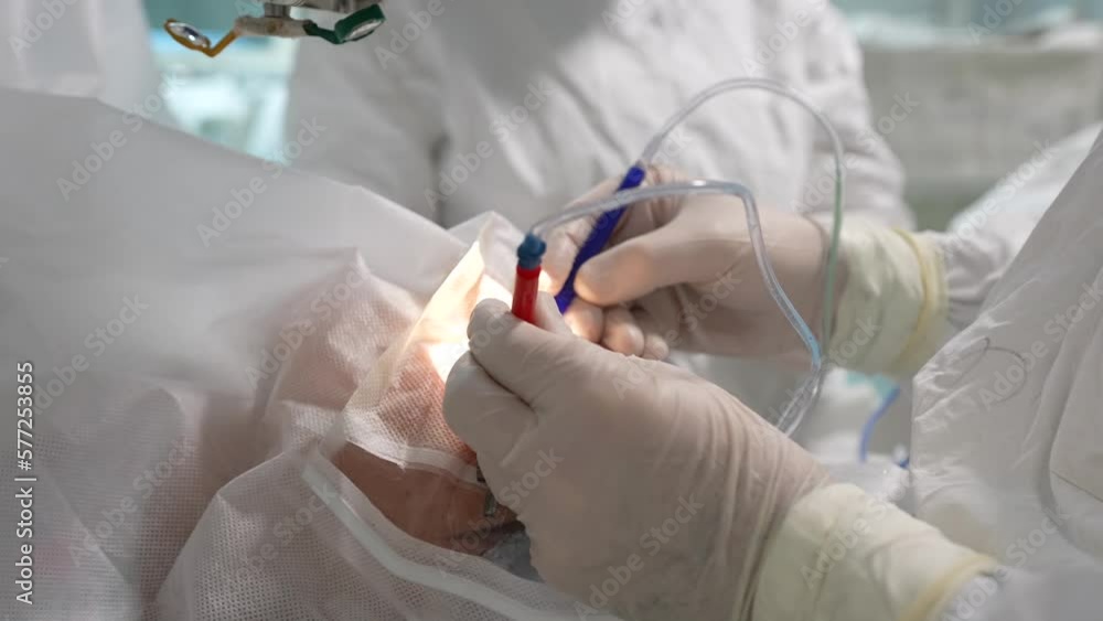 A patient and team of surgeons in the operating room during ophthalmic surgery. Patient under sterile cover. Cataract surgery in operation room.
A patient and team of surgeons in the operating room during ophthalmic surgery. Patient under sterile cover. Cataract surgery in operation room.