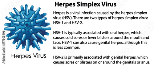 Herpes Simplex Virus with explanation