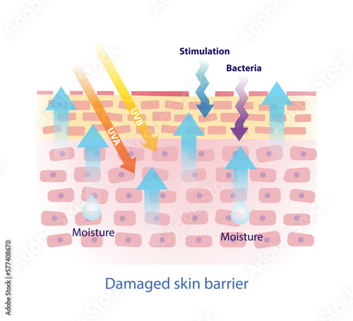 Damaged skin barrier vector on white background. The weak skin barrier make tight arrangement between cells is lost, irritants to get in easier and dehydrated skin. Skin care and beauty concept.