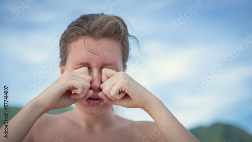 Close up of a woman scratching itchy and rub eyes with her hands in a park, problems with vision, allergy photo