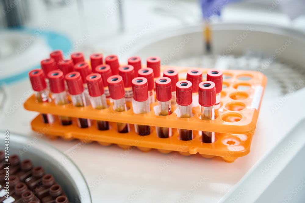 Naklejka premium Rack of blood tubes with barcode labels for proper identification