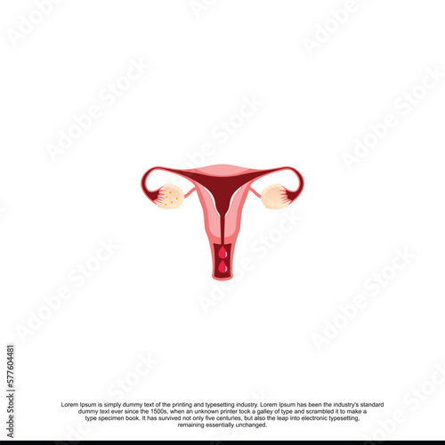 Abnormal Uterine Bleeding Concept, Extremely heavy period. photo