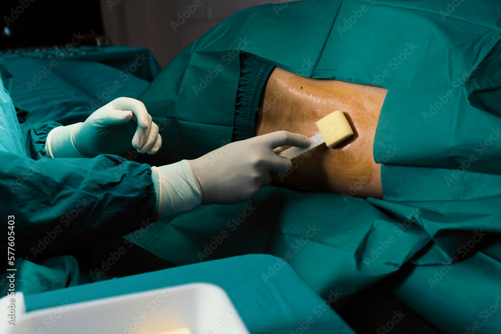 Doctor or surgeon apply betadine to the patient for anesthesia