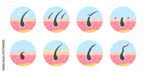 hair follicles on human skin hair disorder hair care