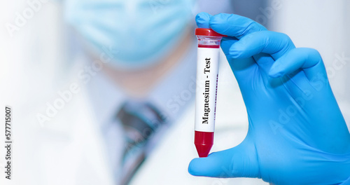 Doctor holding a test blood sample tube with Magnesium test.