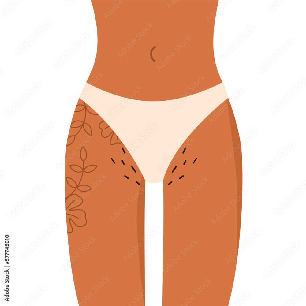 Female hips with flower tattoo and hairy bikini. Pubic hair. Body Positive,  normalize female body hair. Vector illustration in cartoon style. Isolated  white background. Stock Vector | Adobe Stock