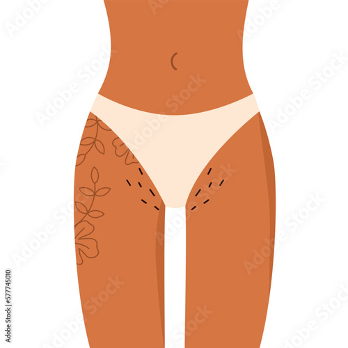Female hips with flower tattoo and hairy bikini. Pubic hair. Body Positive, normalize female body hair. Vector illustration in cartoon style. Isolated white background.