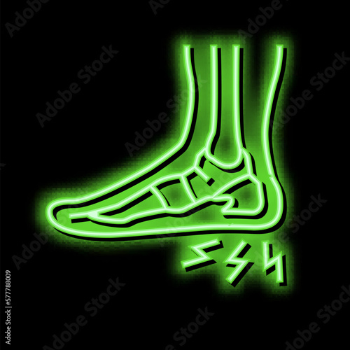 heel spur disease neon glow icon illustration