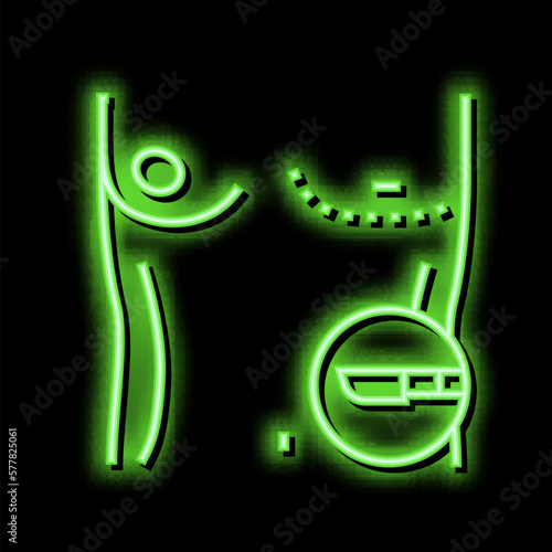 breast gynecomastia disease neon glow icon illustration