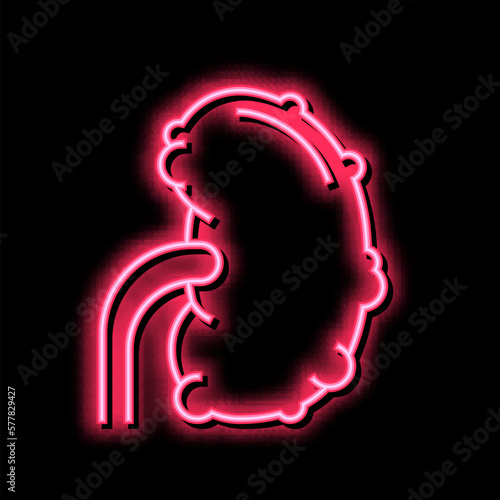chronic pyelonephritis neon glow icon illustration