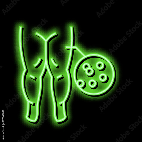 hypoproteinemic edema neon glow icon illustration