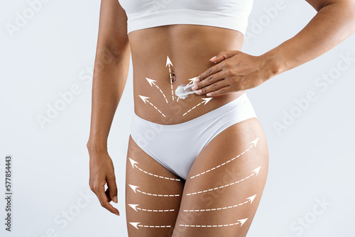 Millennial slim black woman in lingerie with abstract lines, enjoy anticellulite treatment photo