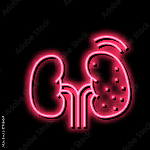 cancer kidney neon glow icon illustration