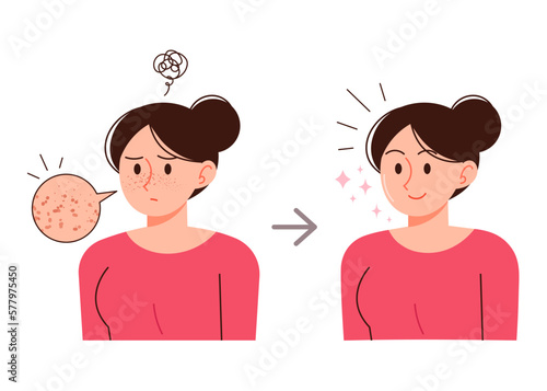 A woman with freckles is smiling happily after removing her freckles. Skin care procedure concept person illustration. photo