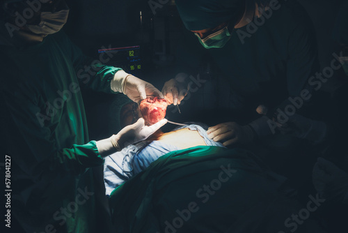 Professional Medical Doctors and team performing surgical operation in bright Modern operating room with lighting equipment in hospital.