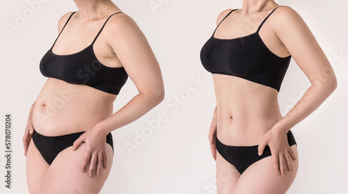 Young woman in black lingerie before and after weight loss on white background. Two shots of female belly with excess fat and toned stomach before and after losing weight. Result liposuction sports