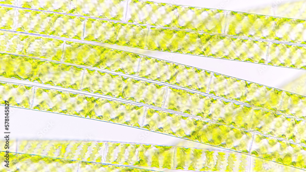 Spirogyra, a filamentous freshwater green algae with spiral arrangement