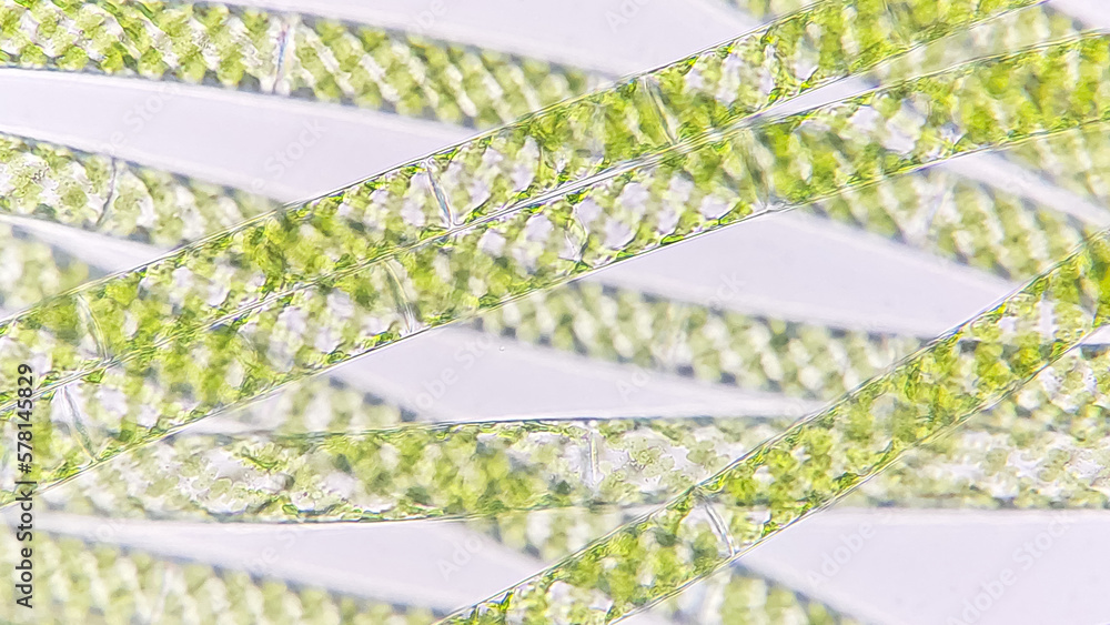 Spirogyra, a filamentous freshwater green algae with spiral arrangement