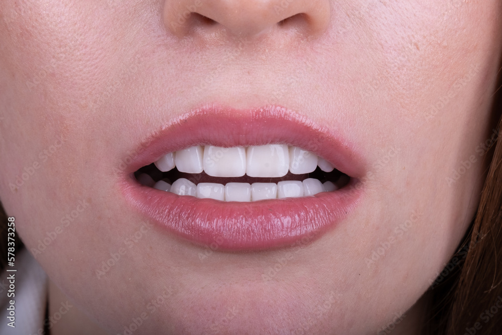 Obraz premium Dental Veneers: Enhance Your Smile with Cosmetic Dentistry.