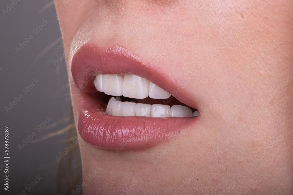 Naklejka premium Dental Veneers: Enhance Your Smile with Cosmetic Dentistry.