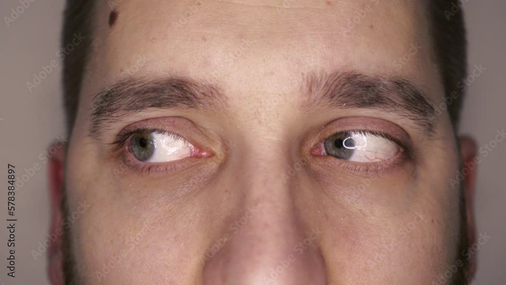 Green eyes close-up with capillaries. The concept of ophthalmology and medicine. Views in different directions. Green eyes close-up with capillaries. The concept of ophthalmology and medicine. Views in different directions.