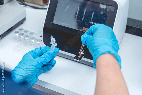 Fotografía Conducting a HbA1c blood test at the laboratory