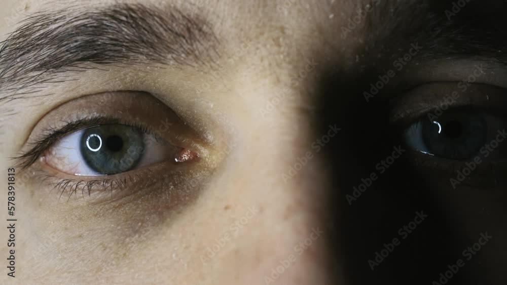 Green eyes close-up with capillaries. The concept of ophthalmology and medicine. Views in different directions. Green eyes close-up with capillaries. The concept of ophthalmology and medicine. Views in different directions.