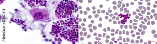 Canvas-taulu Megakaryocyte in red bone marrow (left) and platelets in blood (right)
