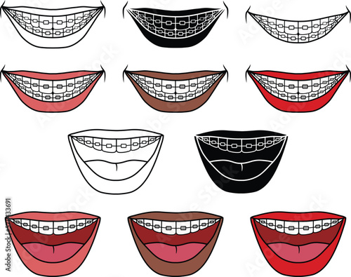 Smile with Teeth and Braces Clipart