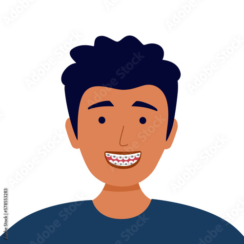 Smiling man with dental braces in flat design on white background. Orthodontic concept vector illustration.