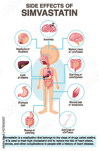 Human anatomy diagram cartoon style of simvastatin side effects