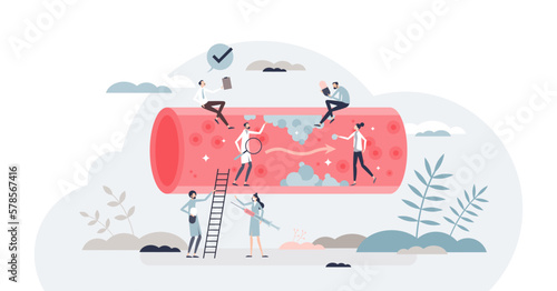 High cholesterol checkup to detect disease or blood risks tiny person concept, transparent background. Heart attack awareness from too high pressure and unhealthy artery illustration.