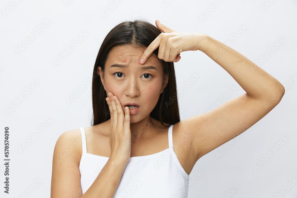 Asian woman facial skin problems, acne and inflammation, red rashes and allergies, chicken pox, sadness from rashes. Facial skin care concept for diseases and nerves Asian woman facial skin problems, acne and inflammation, red rashes and allergies, chicken pox, sadness from rashes. Facial skin care concept for diseases and nerves