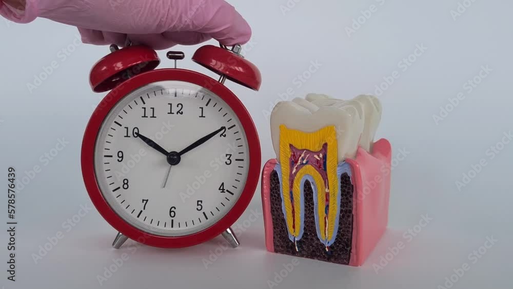 Doctor dentist anatomy of tooth with caries and alarm clock. Time and ...
