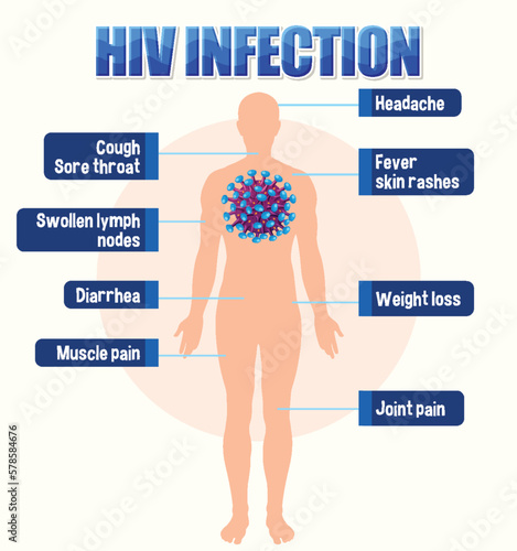Informative poster of of HIV infection