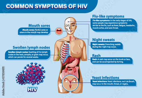 Informative poster of common symptoms of HIV