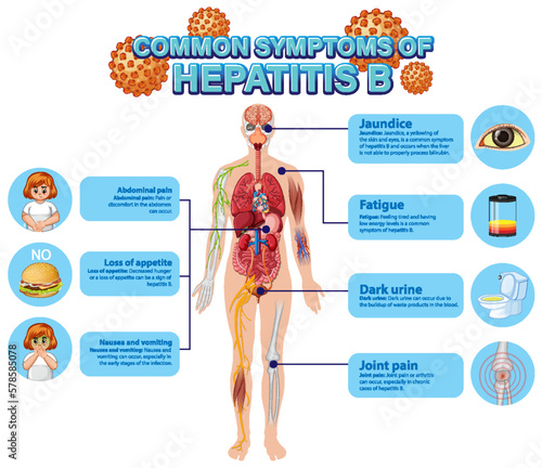 Informative poster of common symptoms Hepatitis B