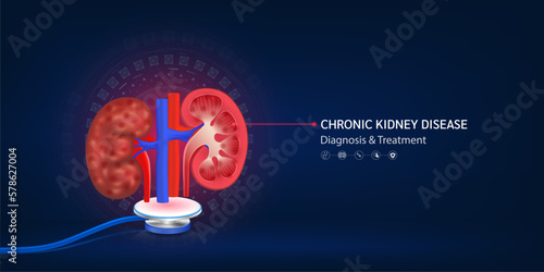 Chronic kidney disease, Human kidneys red model float away from stethoscope. Doctor diagnosis treatment. Medical technology innovation concept. Banner design for pharmacy clinic. 3d Vector.