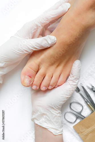Obraz na plátne Pedicure, podologist