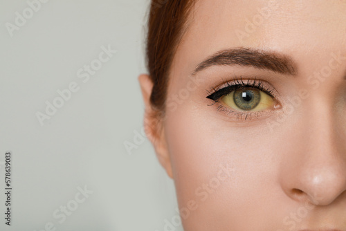 Fototapeta Naklejka Na Ścianę i Meble -  Closeup view of woman with yellow eyes on light grey background, space for text. Hepatitis symptom