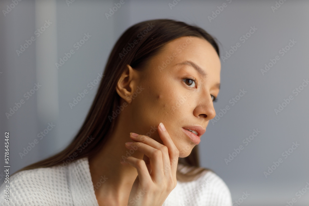 Attractive upset young woman in white bathrobe examines pimples on her face. Problematic skin on the face, acne. Portrait of girl removing pimples in the bathroom. Beauty and health of the skin.