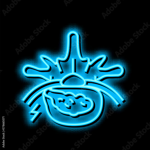 diskectomy patient disease neon glow icon illustration photo