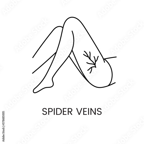 Removal of spider veins with laser cosmetology, line icon in vector female legs