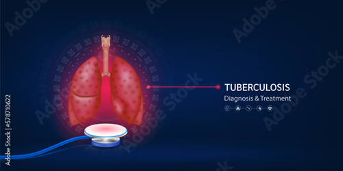 Tuberculosis Pneumonitis disease. Human lungs model float away from stethoscope. Doctor diagnosis treatment. Medical technology innovation concept. Banner design for pharmacy clinic. 3d Vector. photo