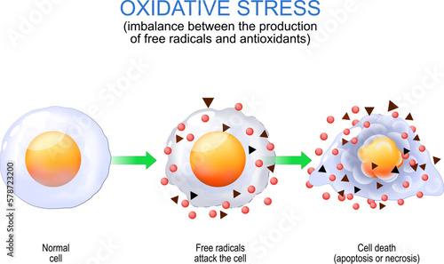 Oxidative stress. free radicals and antioxidants. photo