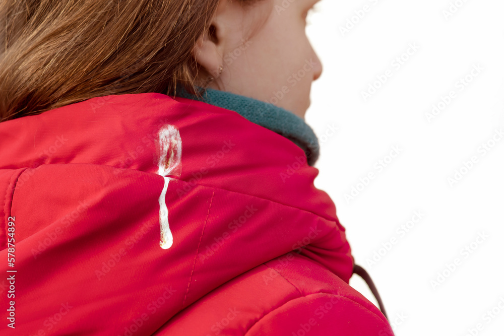 Bird Poop Or Bird Droppings Fell On Girl Shoulders Isolated On White bird-poop-or-bird-droppings-fell-on-girl-shoulders-isolated-on-white