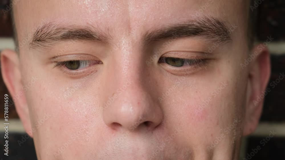 Sweaty face of a worried man with shifty eyes, close-up Sweaty face of a worried man with shifty eyes, close-up